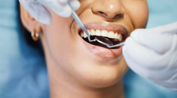 Best Emergency Dental Care for Broken or Chipped Teeth in Florence, KY